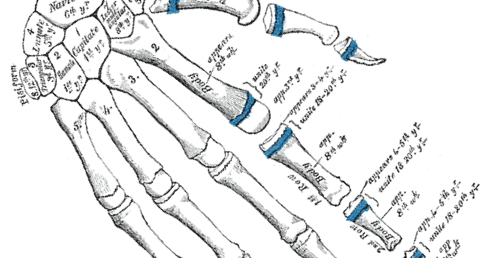 Gray234_rotate Gray234_rotate